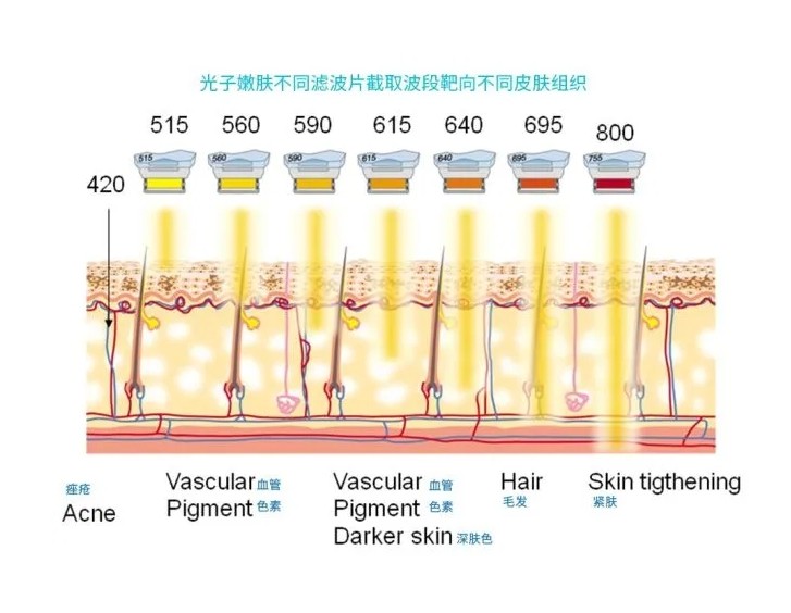五大光子嫩膚技術(shù)（IPL、DPL、OPT、APT、BBL）及濾光片區(qū)別