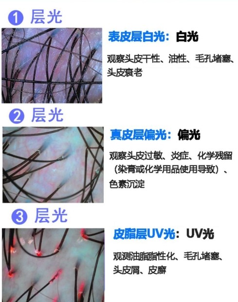 不同光對(duì)頭發(fā)的觀測(cè)效果