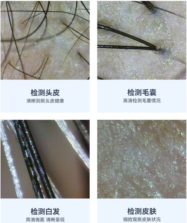 頭皮檢測(cè)儀的功能效果